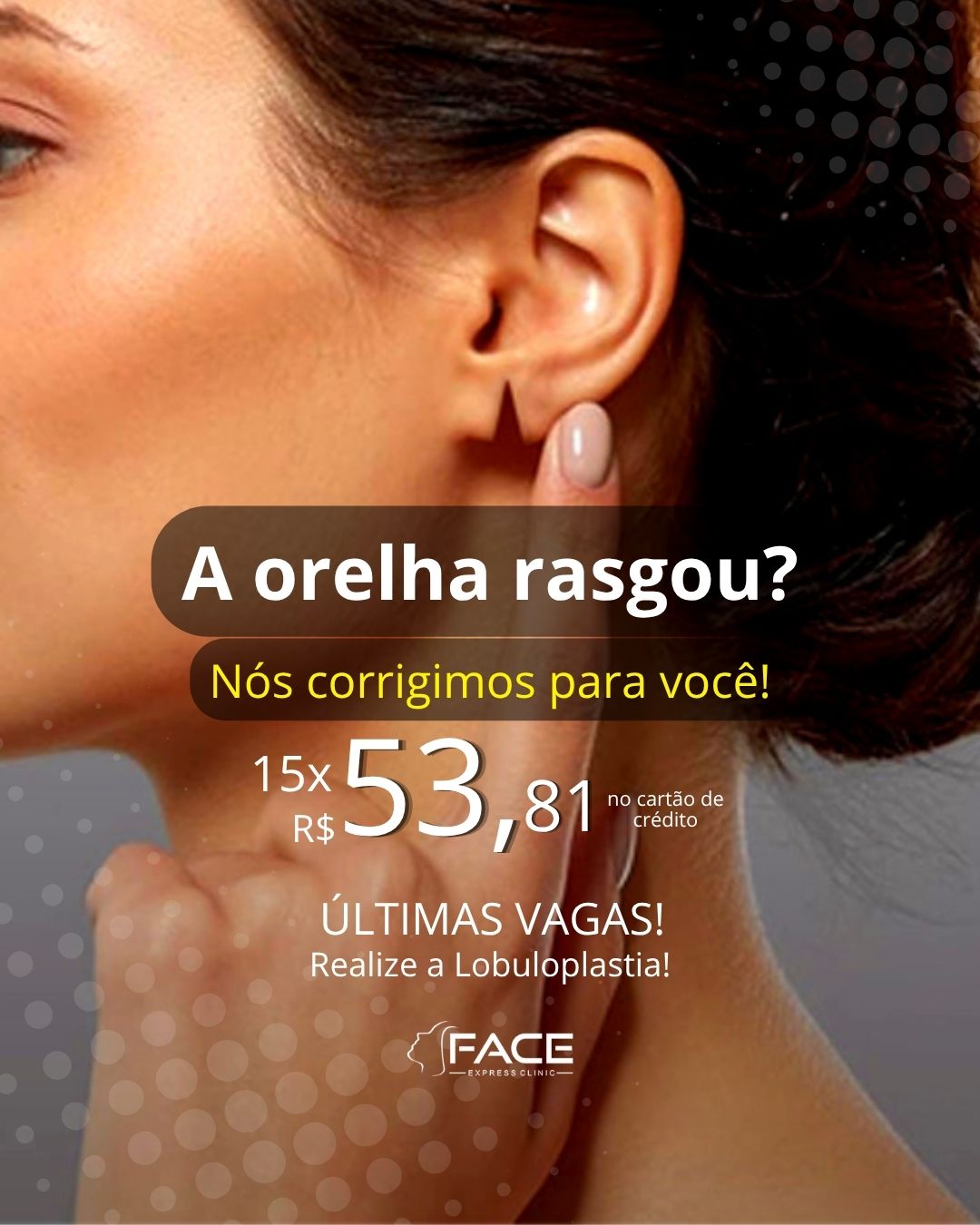 FACE Express Clinic Facebook ad