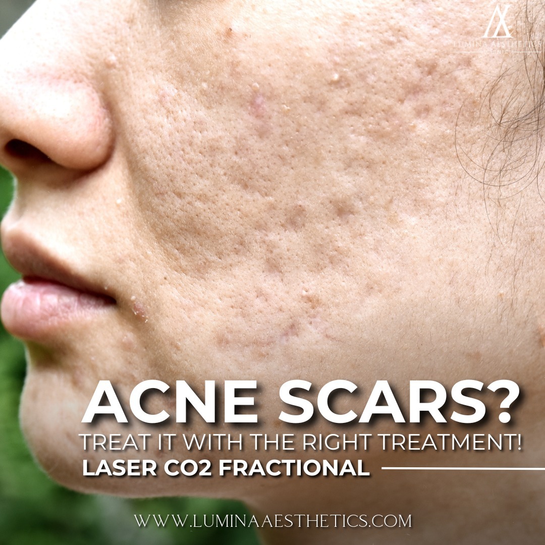Lumina Aesthetics Bali Facebook ad