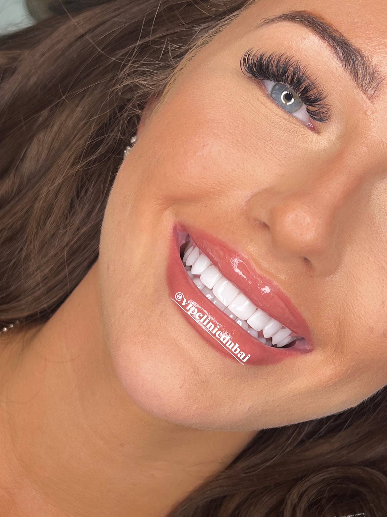 vipclinicdubai Facebook ad: hello wellcome to VIP Dental clinic dubai how…