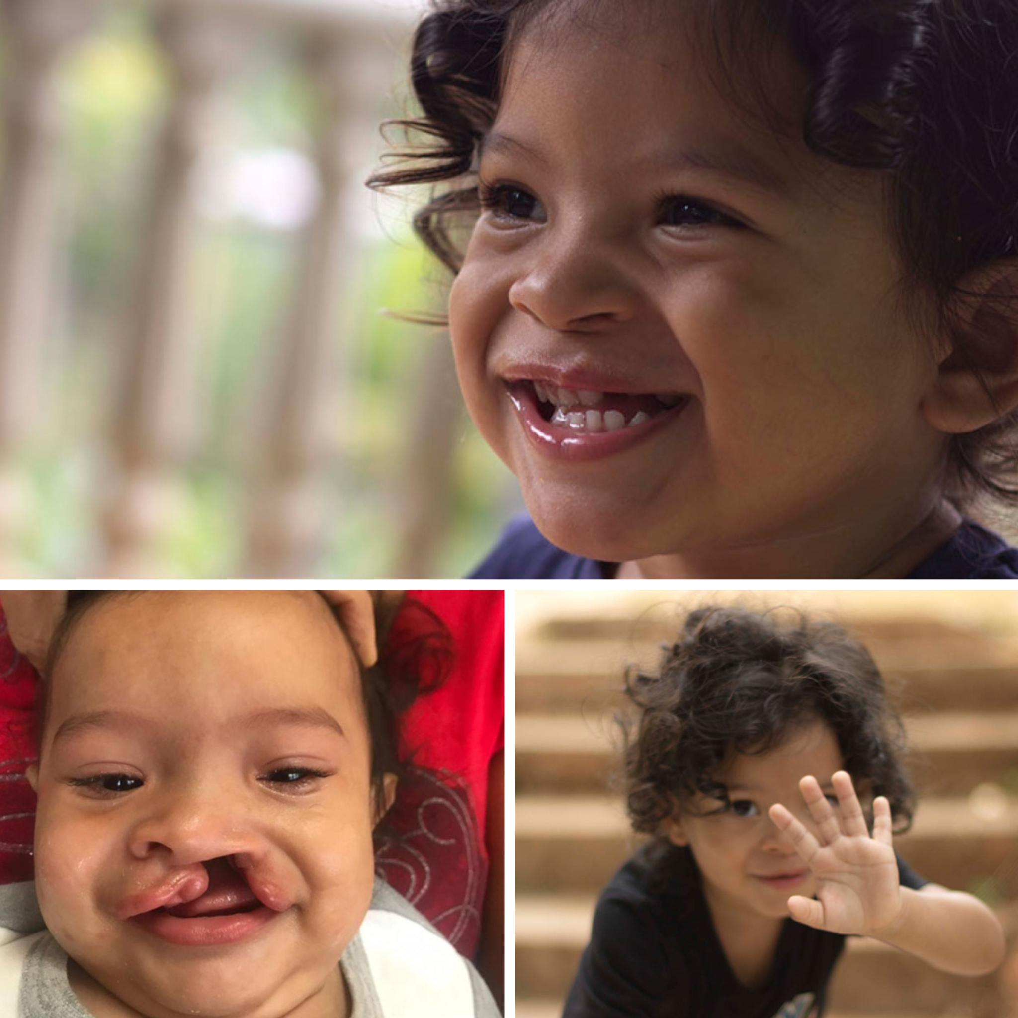 Smile Train Facebook ad
