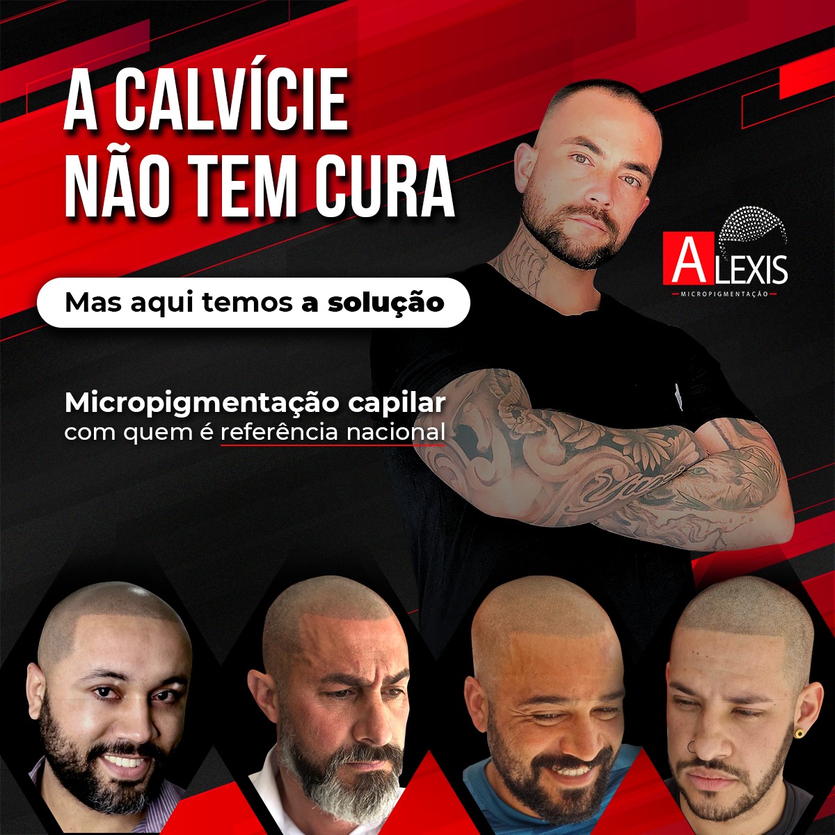 Alexis Micropigmentação Capilar Facebook ad: Que tal você com um visual novo e…