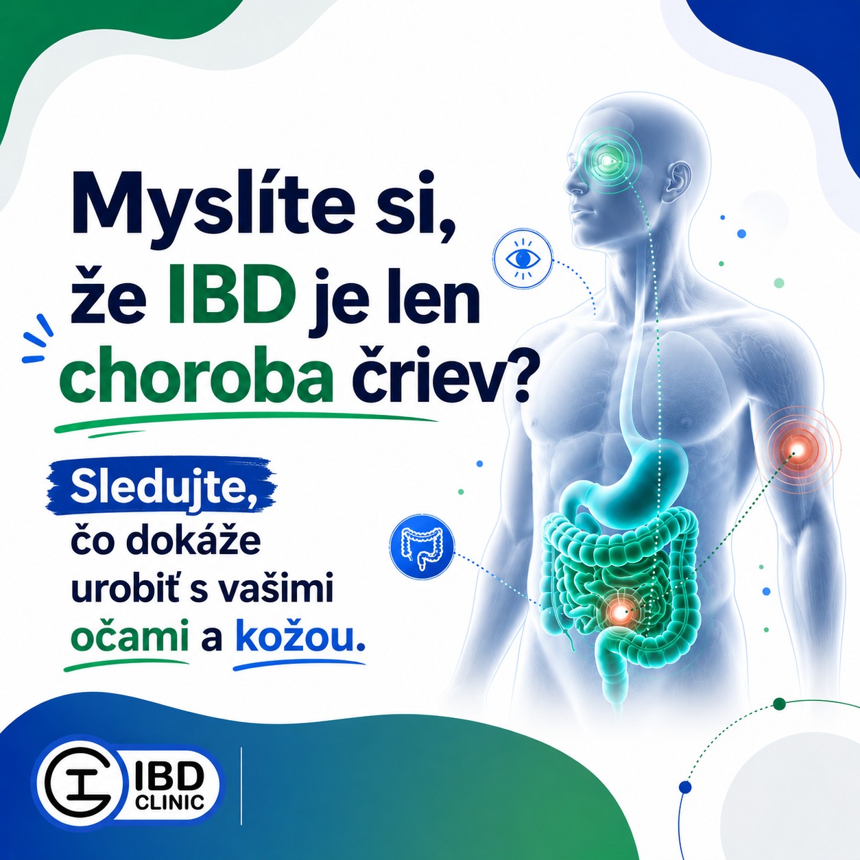 IBD Clinic SK Facebook ad: IBD dokáže zaútočiť aj na vaše oči, kožu…