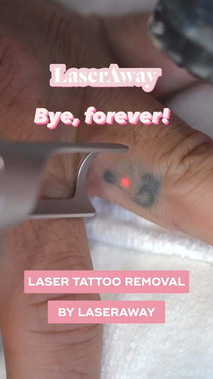 LaserAway Facebook ad: Erase Unwanted Ink