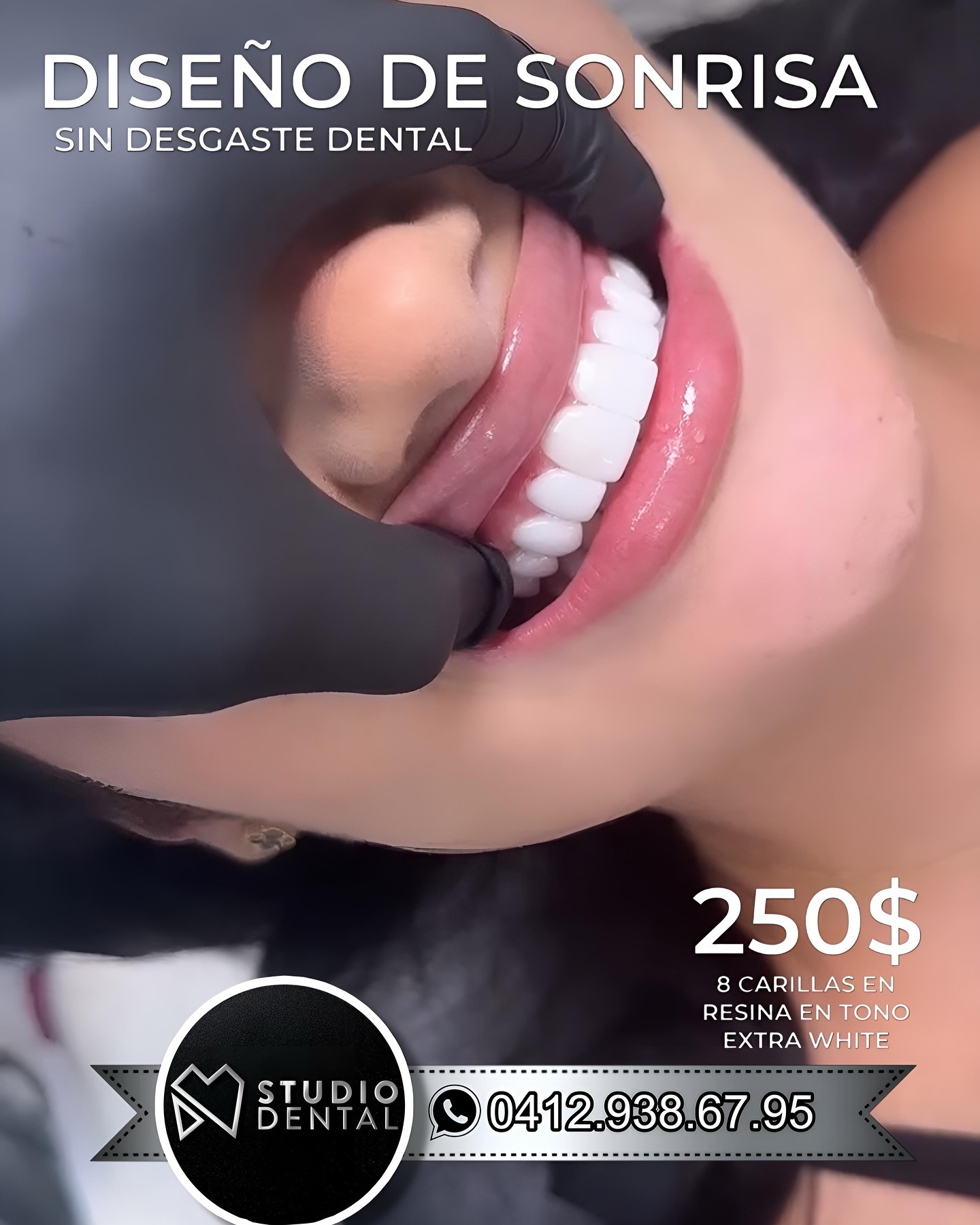 Studio-CCS Facebook ad: Diseño de sonrisa, sin desgaste dental