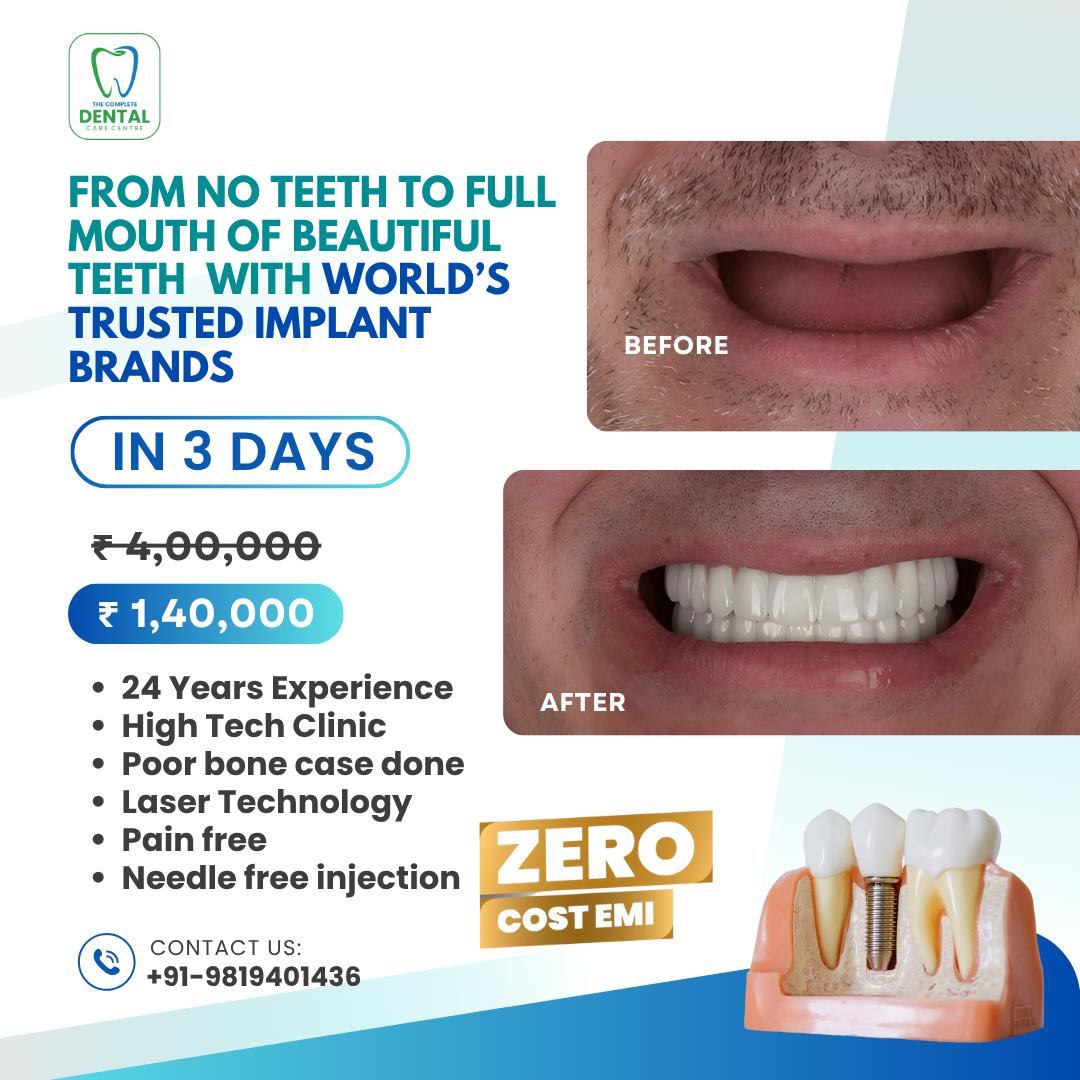 Dental Care Facebook ad
