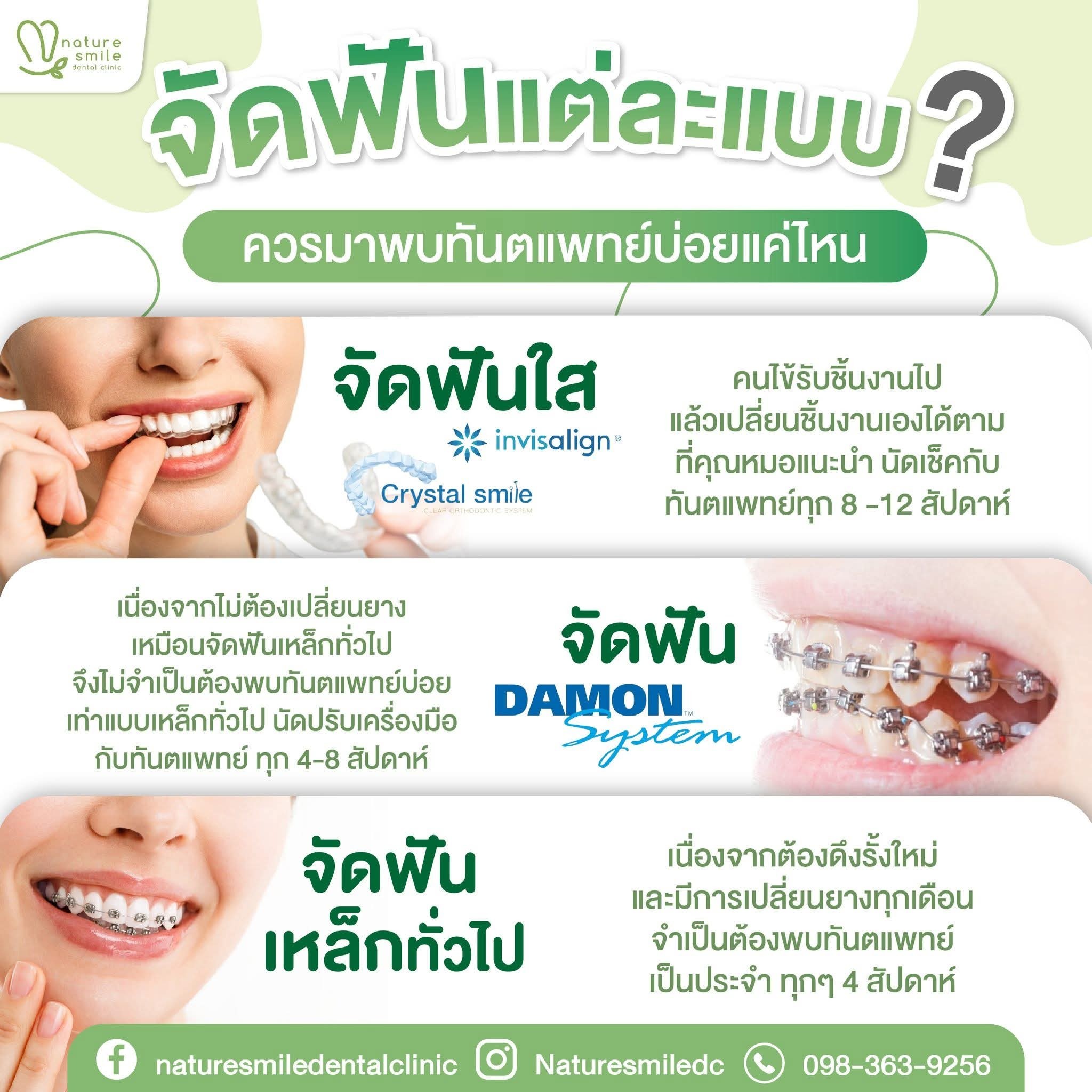 Nature Smile Dental Clinic คลินิกทันตกรรมเนเจอร์สไมล์ จัดฟัน ตลิ่งชัน บรม Facebook ad: ยิ้มใหม่ มั่นใจกว่าเดิม เริ่มต้นที่นี่ Nature Smile Dental