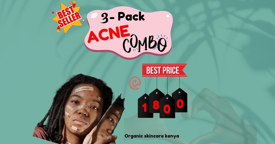 Organic skin care Kenya Facebook ad: OUR ACNE COMBO.BEST SELLER IN TOWN.