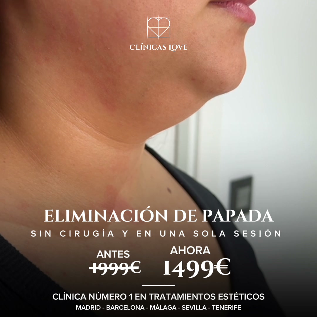 Clínicas Love Barcelona - Cirugía y Medicina Estética Facebook ad: Elimina la Papada por 1.499€