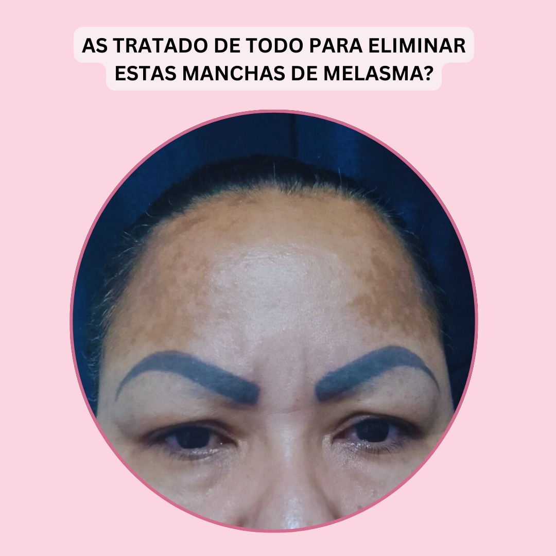 Aclara Facebook ad: ¿Estás cansado de usar cremas que no funcionan?