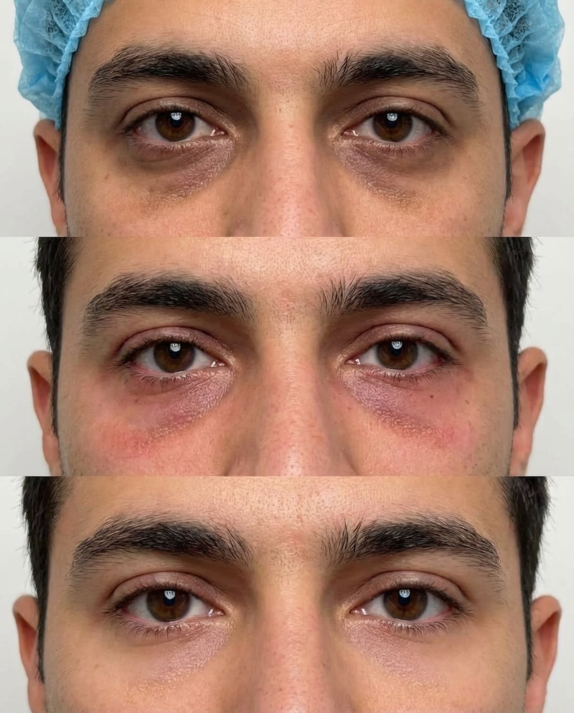My Laser France Facebook ad: Le secret d’un regard frais, lumineux et rajeuni…