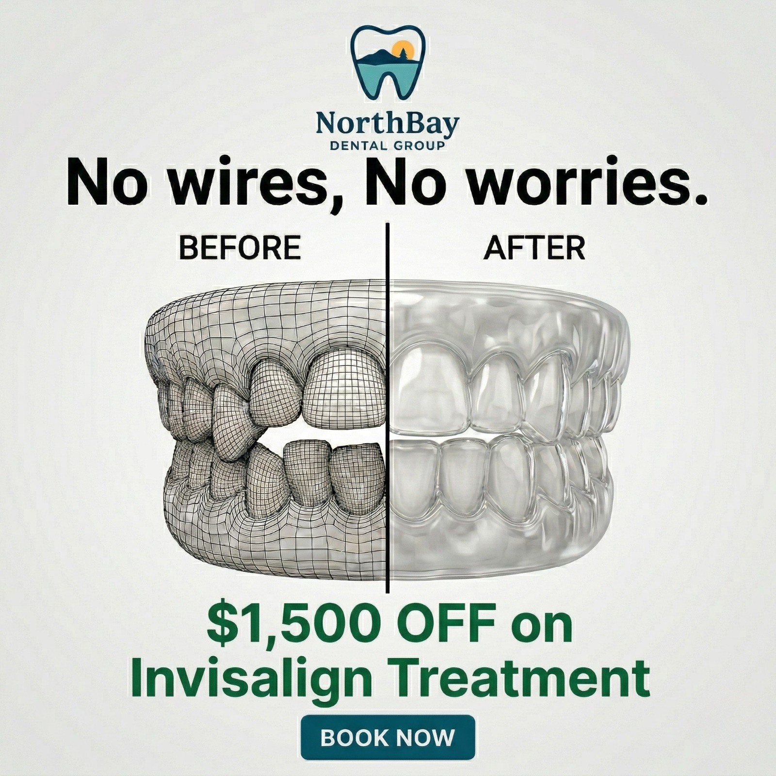 NorthBay Dental Group Facebook ad: Benicia: Get $1,500 OFF Invisalign, Only 12 Spots Left!