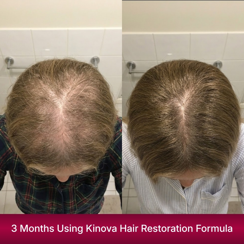 Jennifer Mitchell Facebook ad: Read if You Have Postpartum Hair Loss