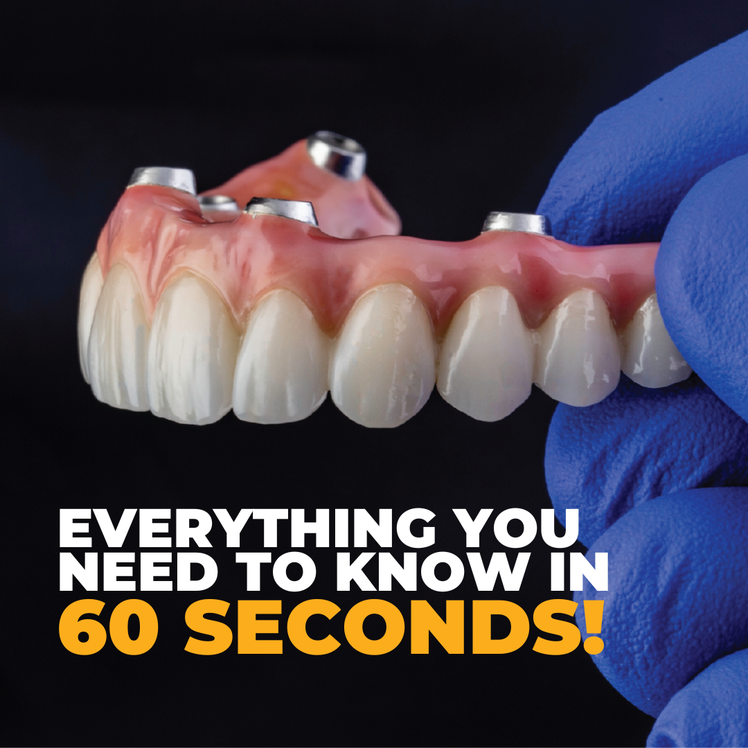 Mason Creek Dental & Dental Implants Facebook ad: Find Out Now!