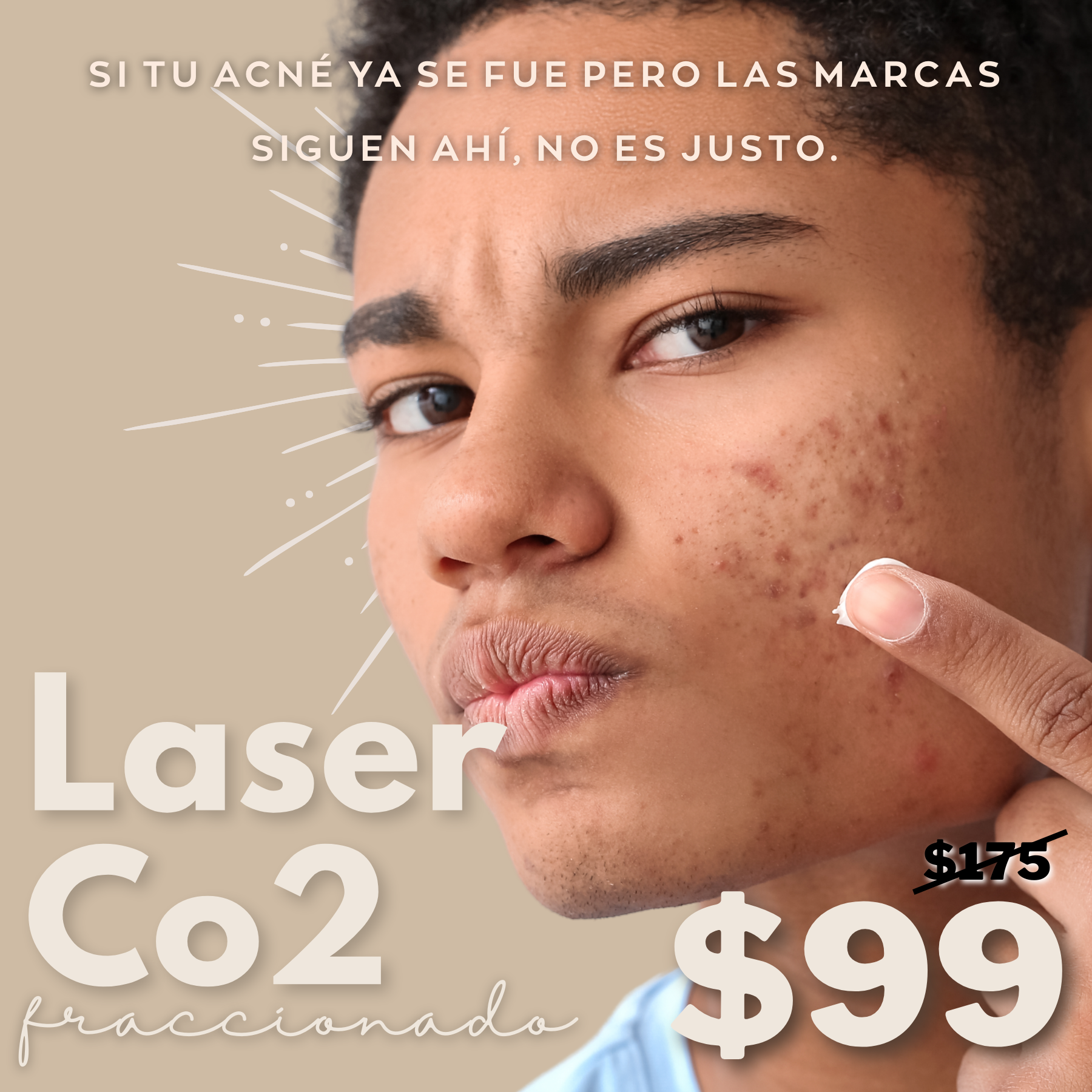 Sol Estetica MED Facebook ad: Quiero eliminar mis manchas