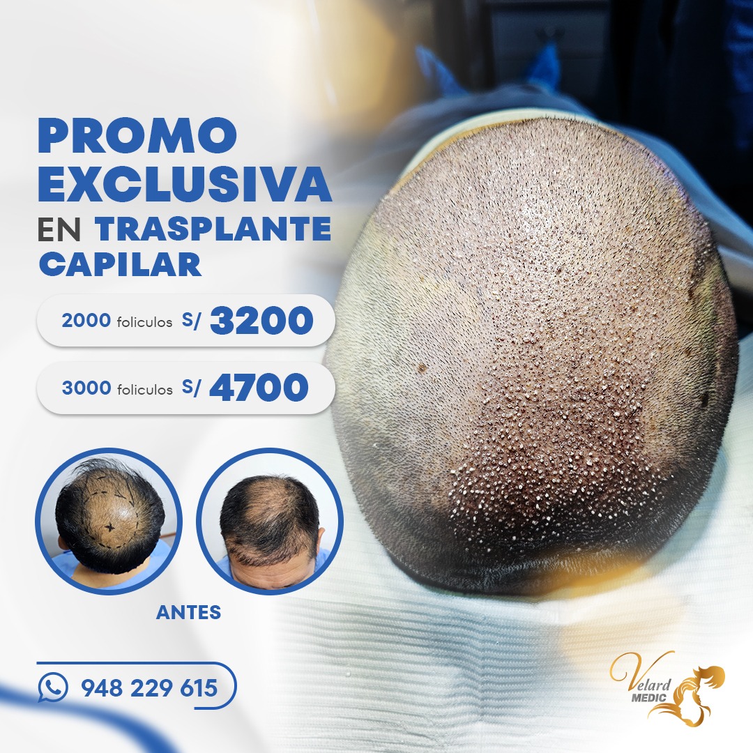 Velard Medic Capilar Facebook ad