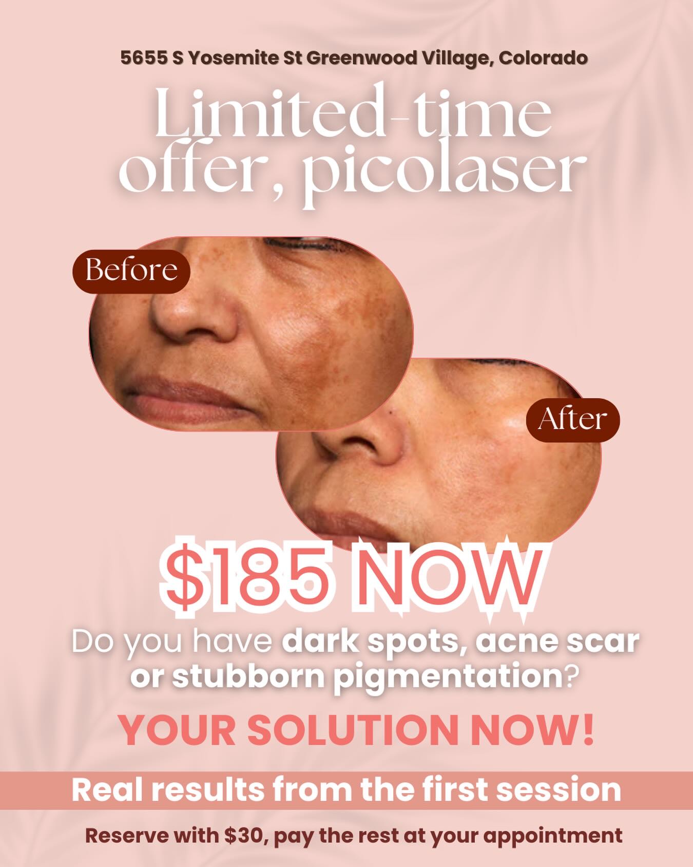 Moza Med Spa Facebook ad: Tired of covering dark spots, sun damage, or…