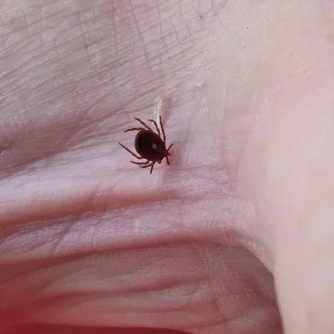 The Natural Healing Journal Facebook ad: A tick gave my 9 year old a lifelong allergy in 90…