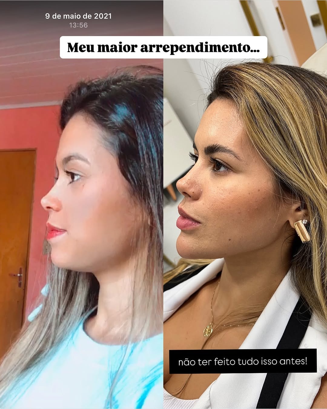 Drajessicamaral Facebook ad: E HOJE EU POSSO FALAR TENHO AUTOESTIMA rs…