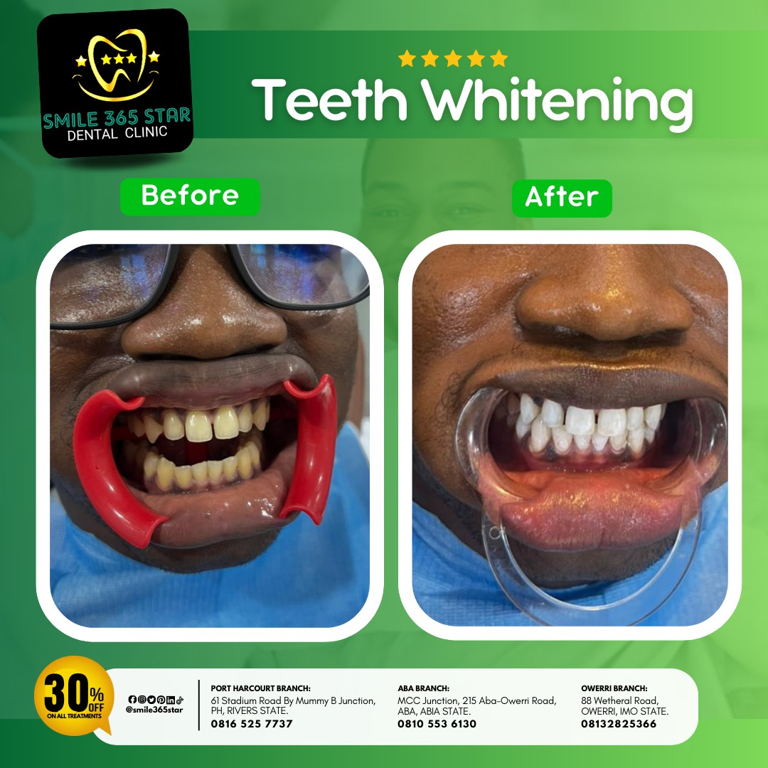 Smile 365 Star Dental Clinic Facebook ad: Exciting News from Smile 365 Star Dental Clinic!