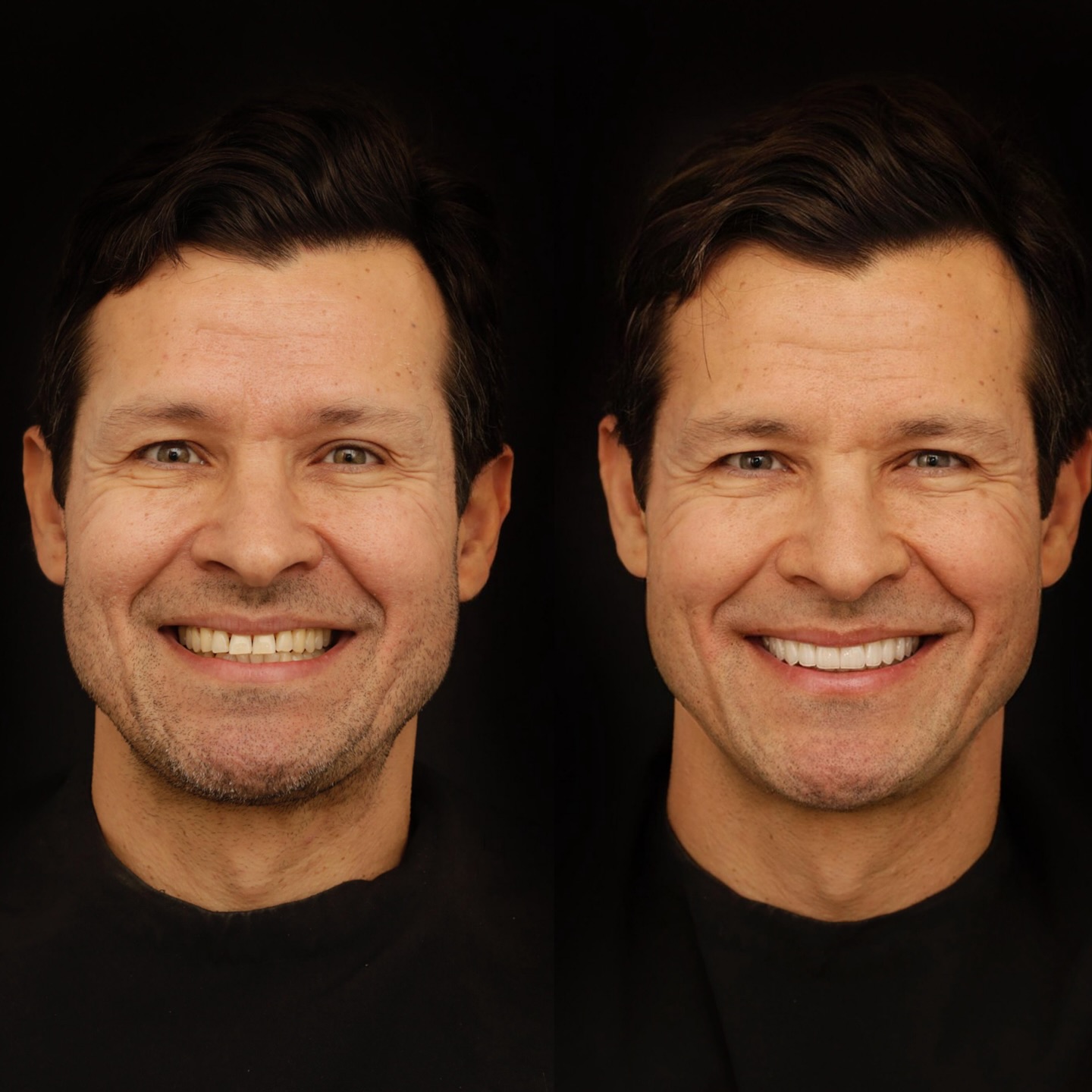 Rildo Lasmar Odontologia e Estética Facebook ad