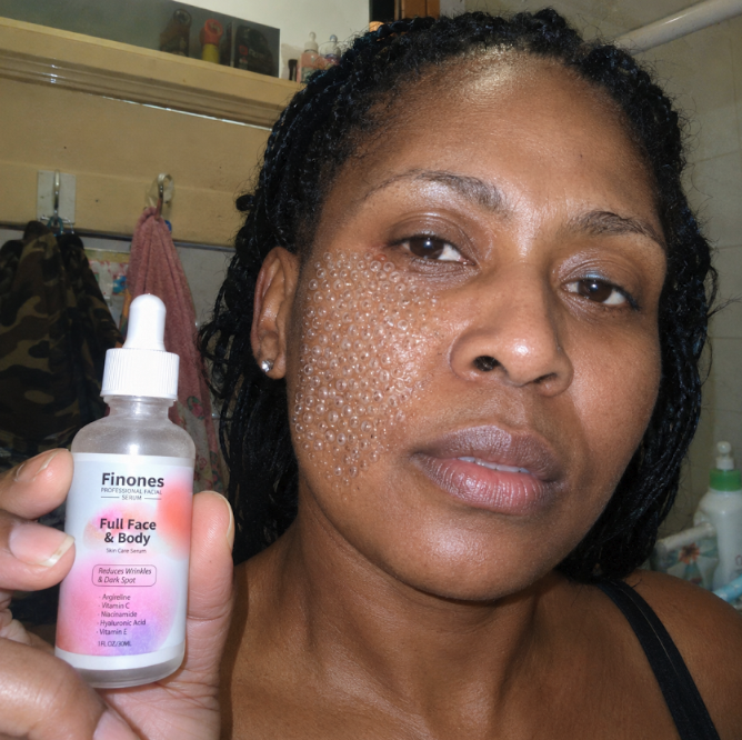 Skin Finones News Facebook ad