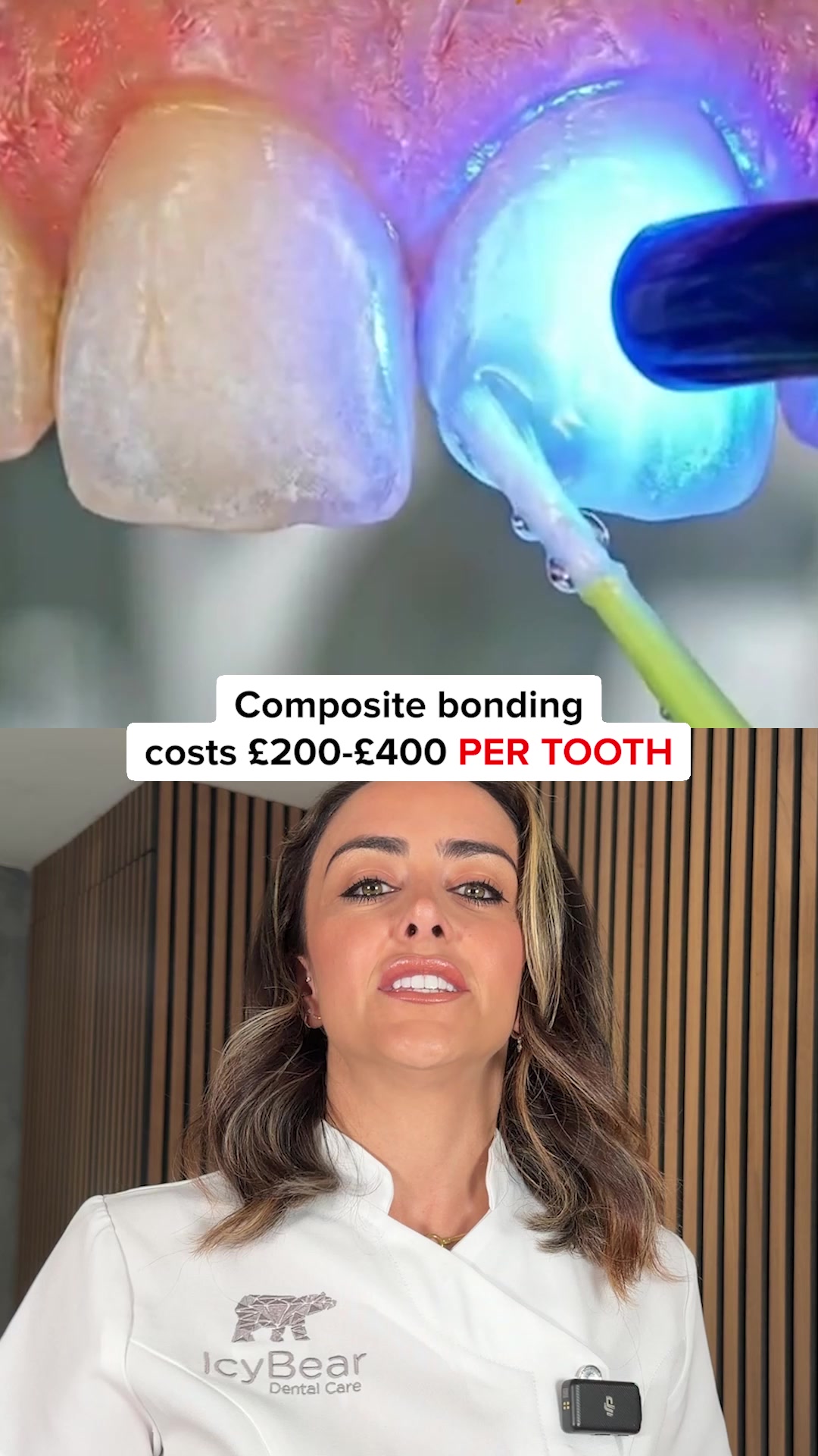 Icy Bear Dental Facebook ad: Back in Stock. Whiter Teeth Fast.