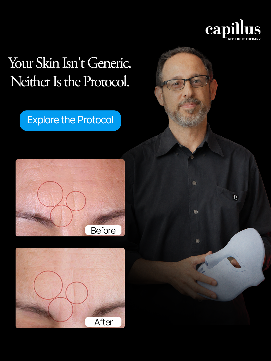 Capillus Facebook ad