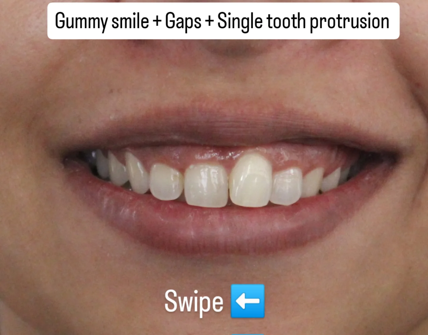 All Smiles Dental Clinic,Bangalore-center for cosmetic dentistry Facebook ad