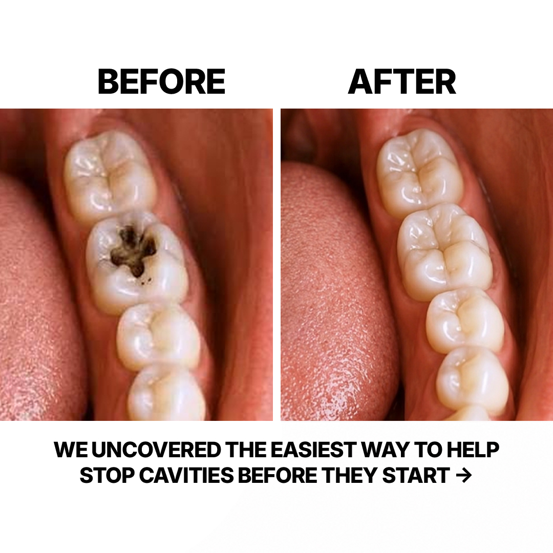 The Dental Diaries Facebook ad: Say Goodbye to Cavities Today!