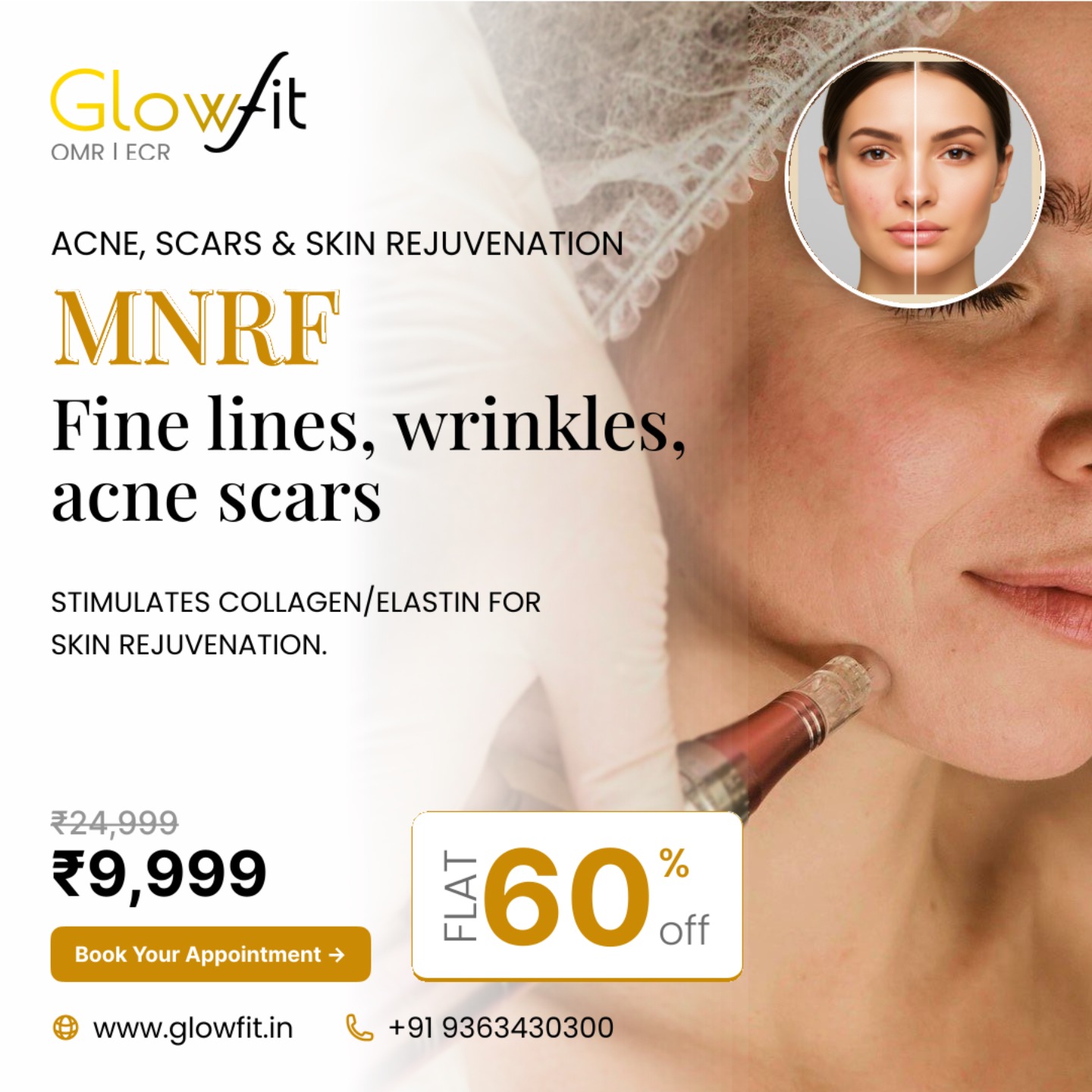 GlowFit Cosmetic Clinic Facebook ad
