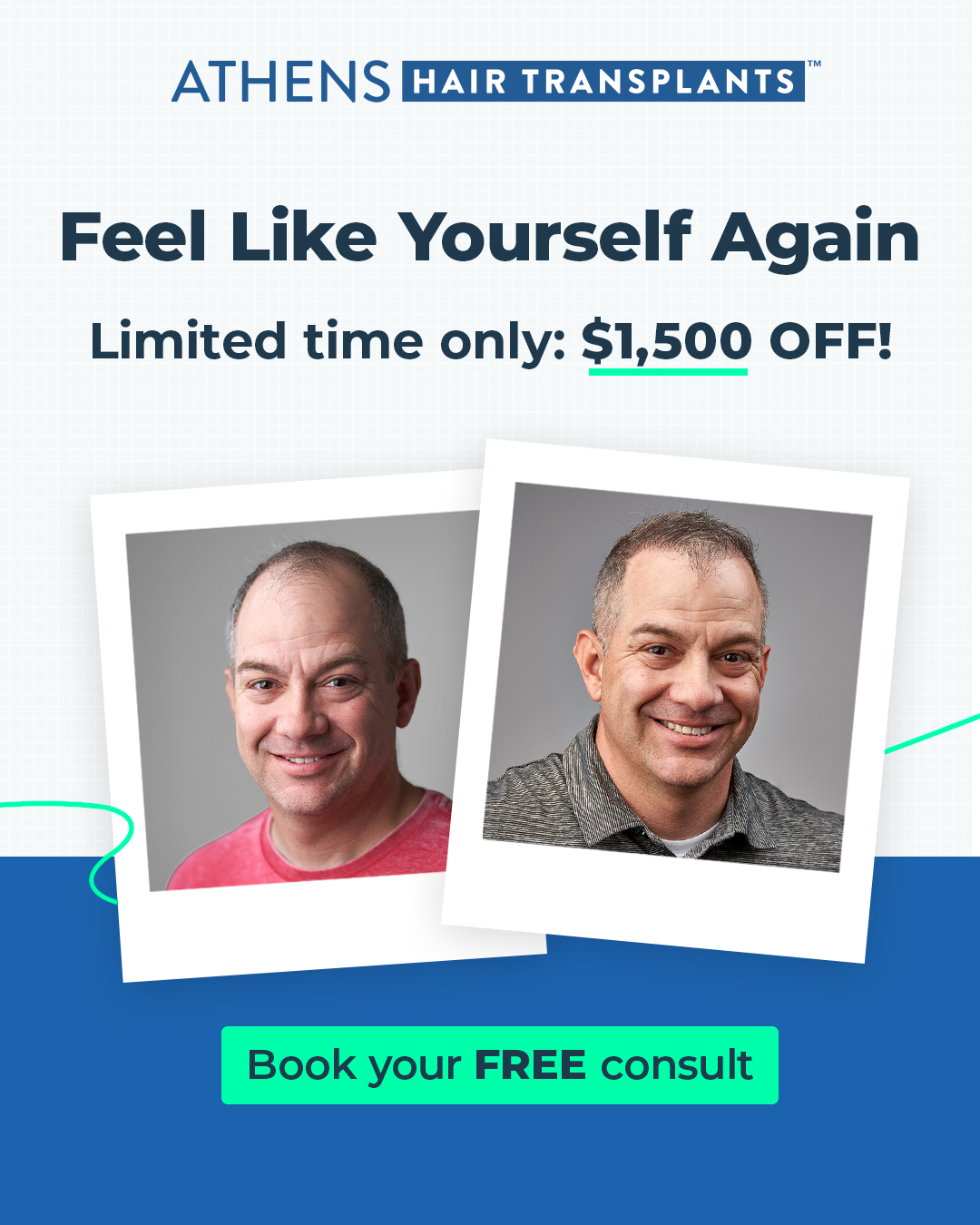 Athens Hair Transplants Facebook ad from Nov 17, 2025