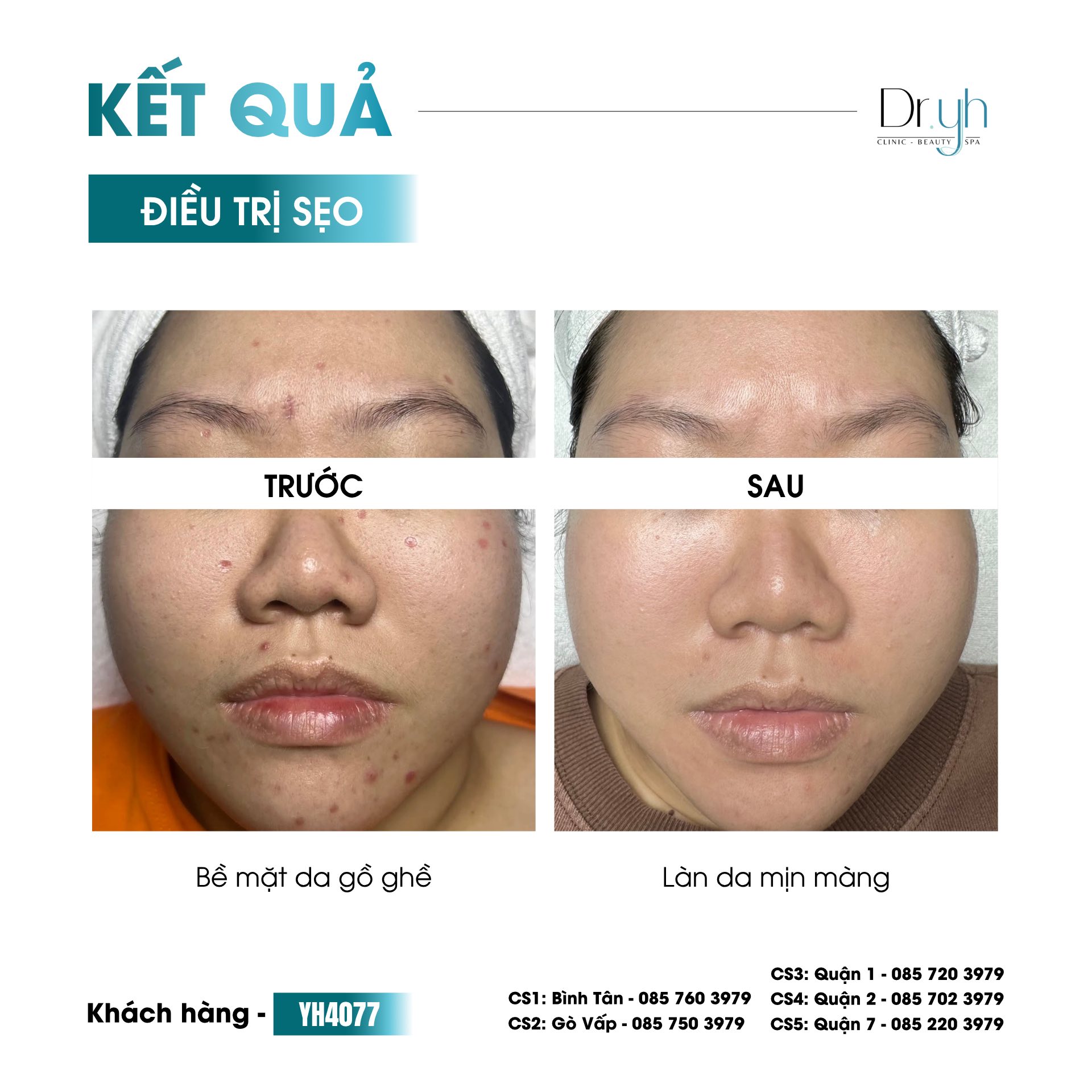 DR.YH Clinic & Spa Quận 7 Facebook ad: 𝐃𝐫.𝐘𝐇 𝐂𝐚𝐬𝐞𝐥𝐢𝐛𝐫𝐚𝐫𝐲 | 𝐂𝐚̉𝐢 𝐭𝐡𝐢𝐞̣̂𝐧…