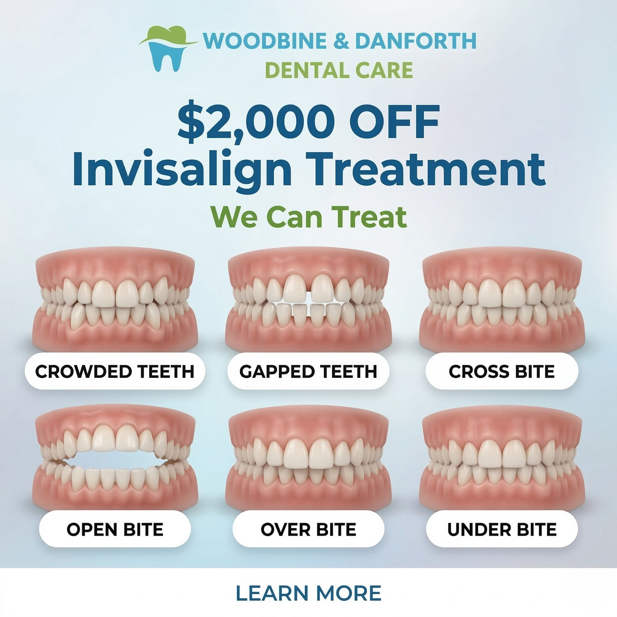 Woodbine & Danforth Dental Care Facebook ad: Exclusive Toronto's Deal: $2000 OFF Invisalign Treatment +…