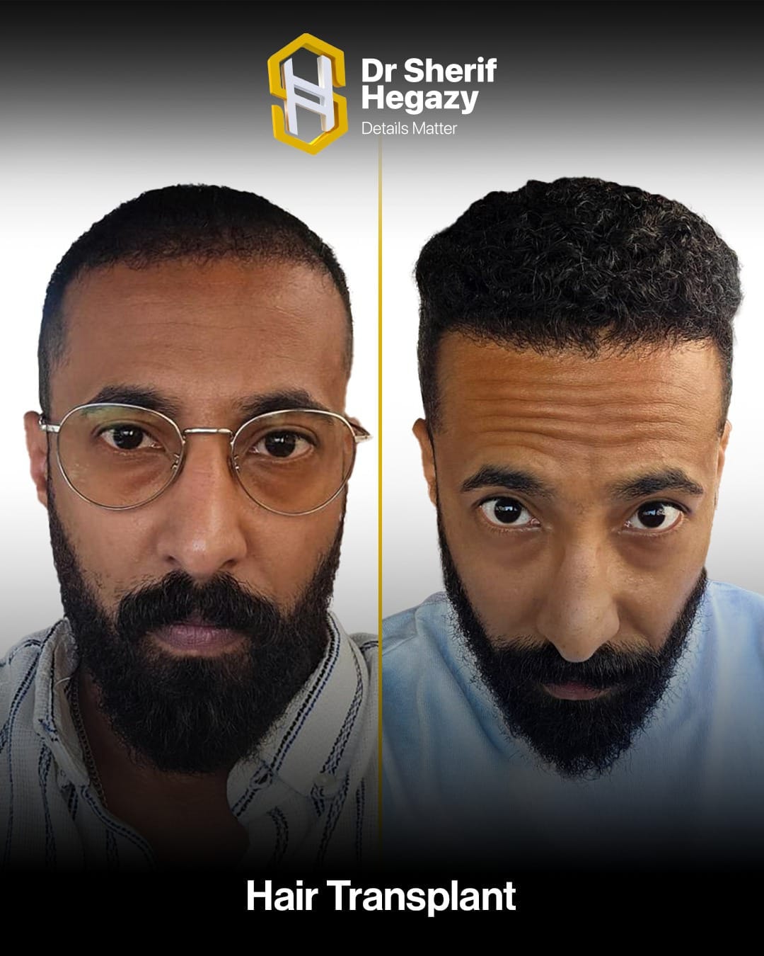 Dr. Sherif Hegazy Facebook ad