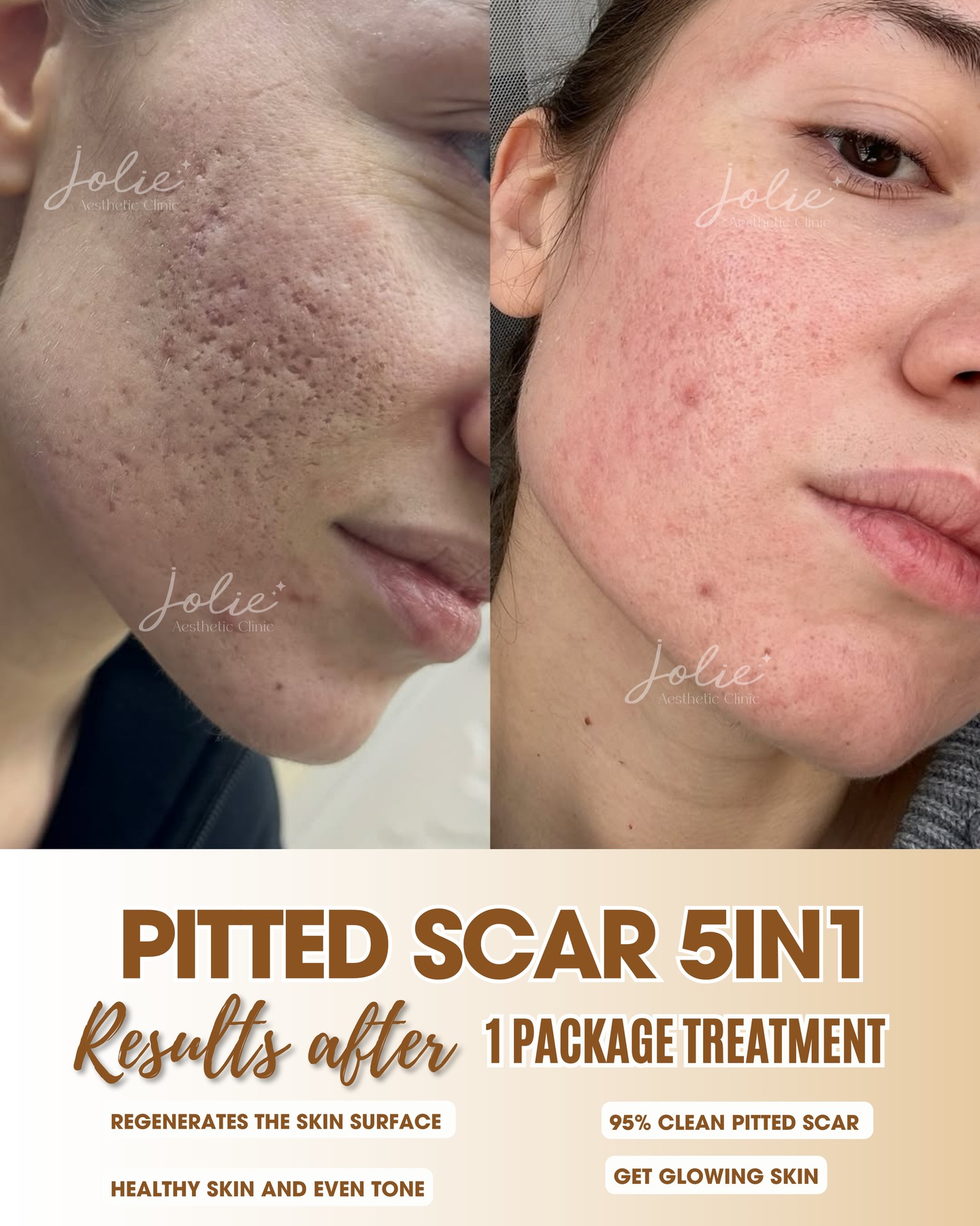 Jolie Perfect SkinM1 Facebook ad