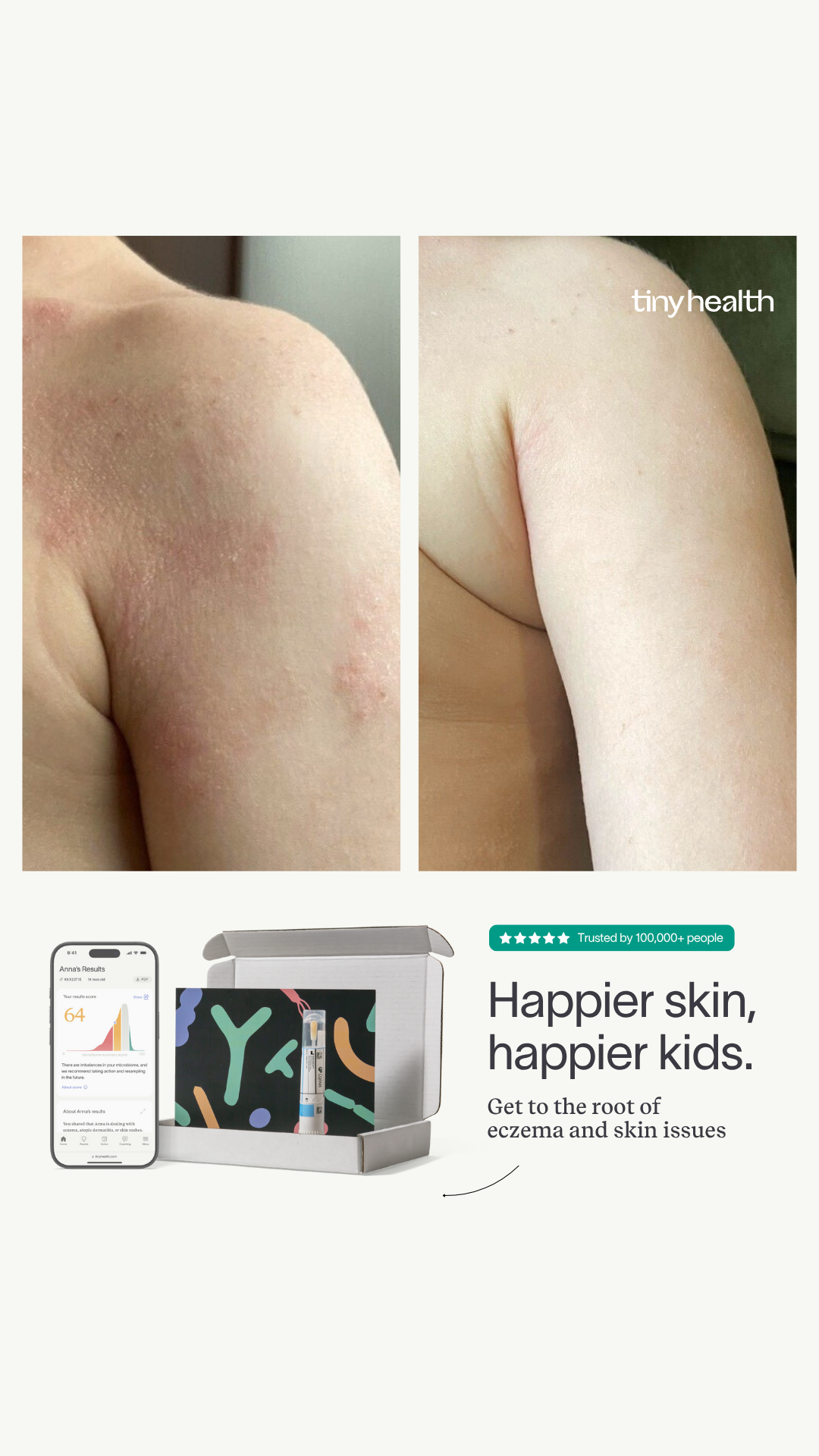 TinyHealth Facebook ad