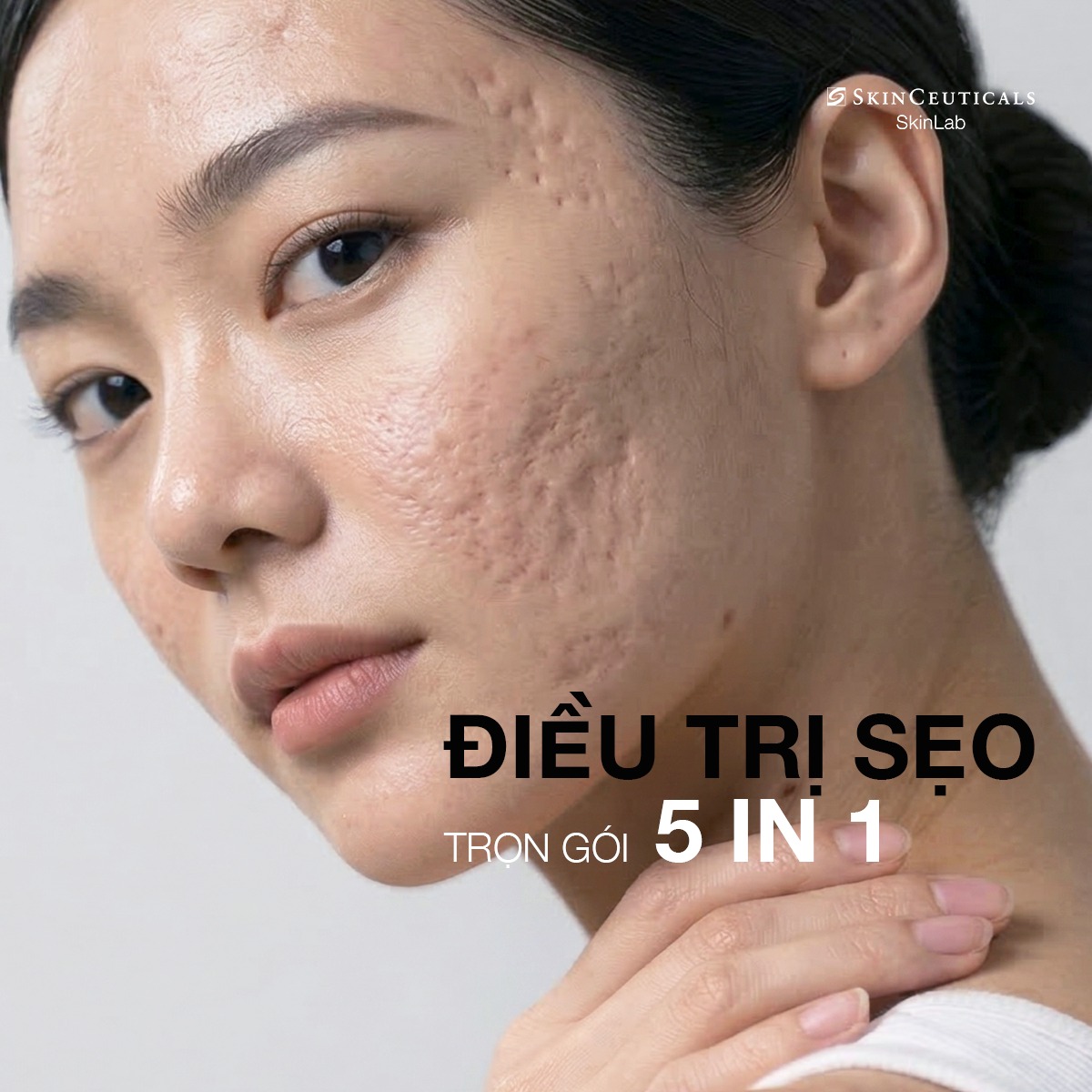 SKC SkinLab Vietnam Facebook ad