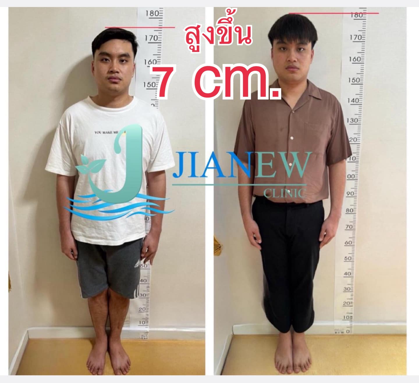 Jianew Clinic คลินิกฝังเข็ม การแพทย์แผนจีน Facebook ad