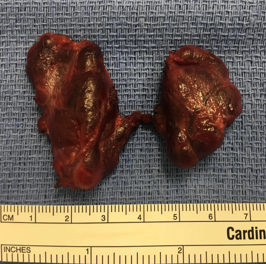 Thyroid Health Daily Facebook ad: Read this if you're scared to take GLP-1