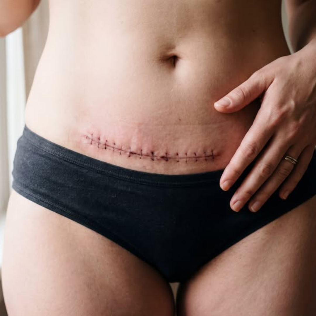 Women Health Tips Facebook ad