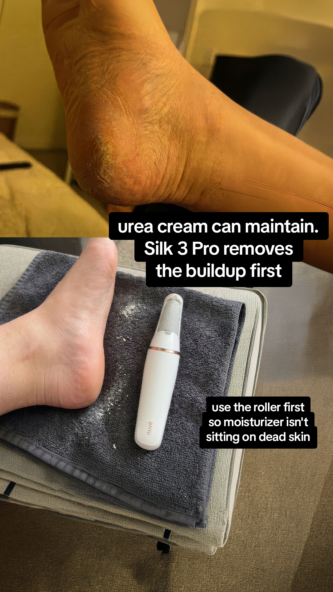 Nuvé Facebook ad: Baby soft feet in 5 minutes flat