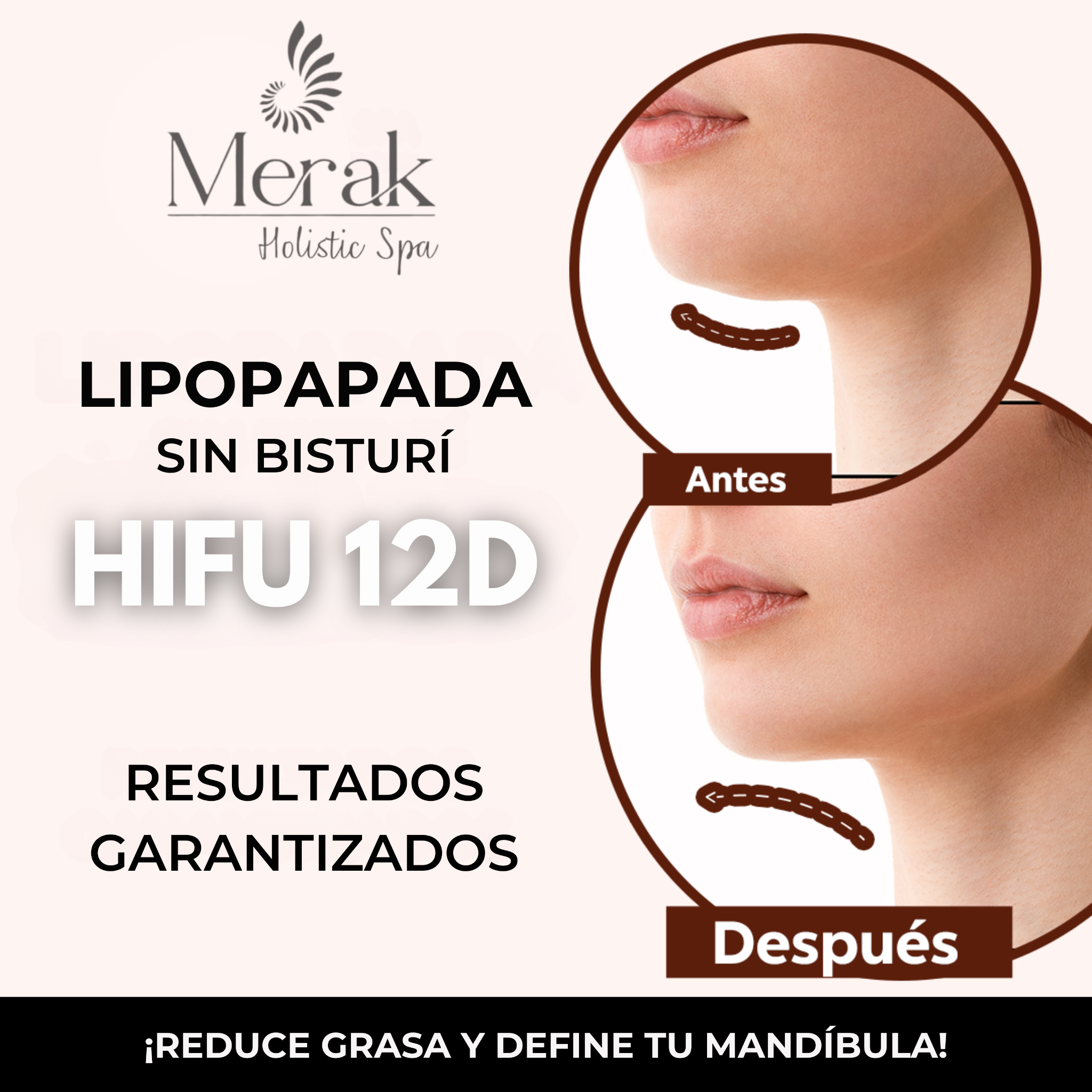 Merak Holistic Spa Facebook ad: LIPOPAPADA CON HIFU! (ELIMANA GRASA)