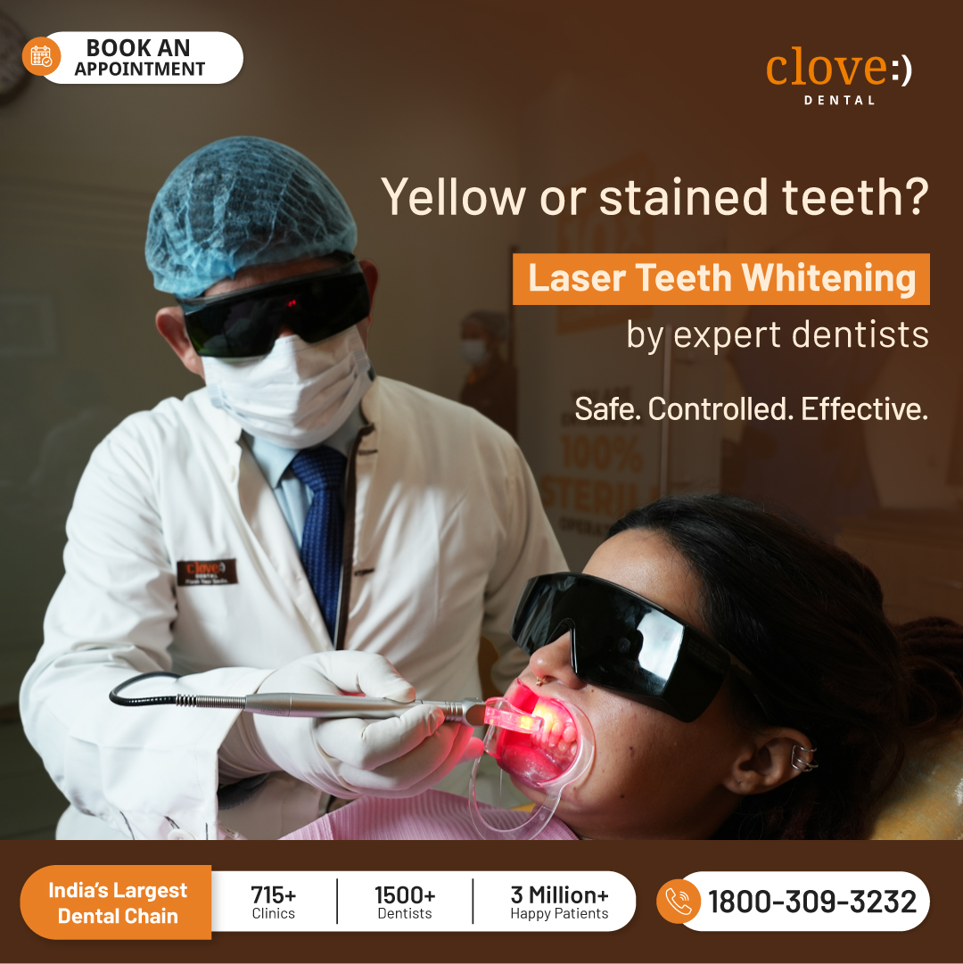 Clove Dental Facebook ad