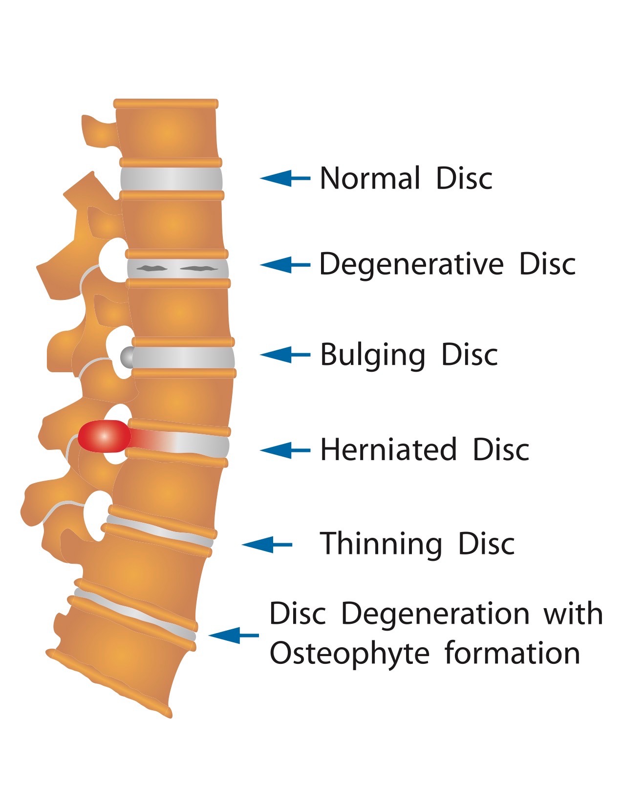 Dr Gary Bolen Venice Village Chiropractic Facebook ad