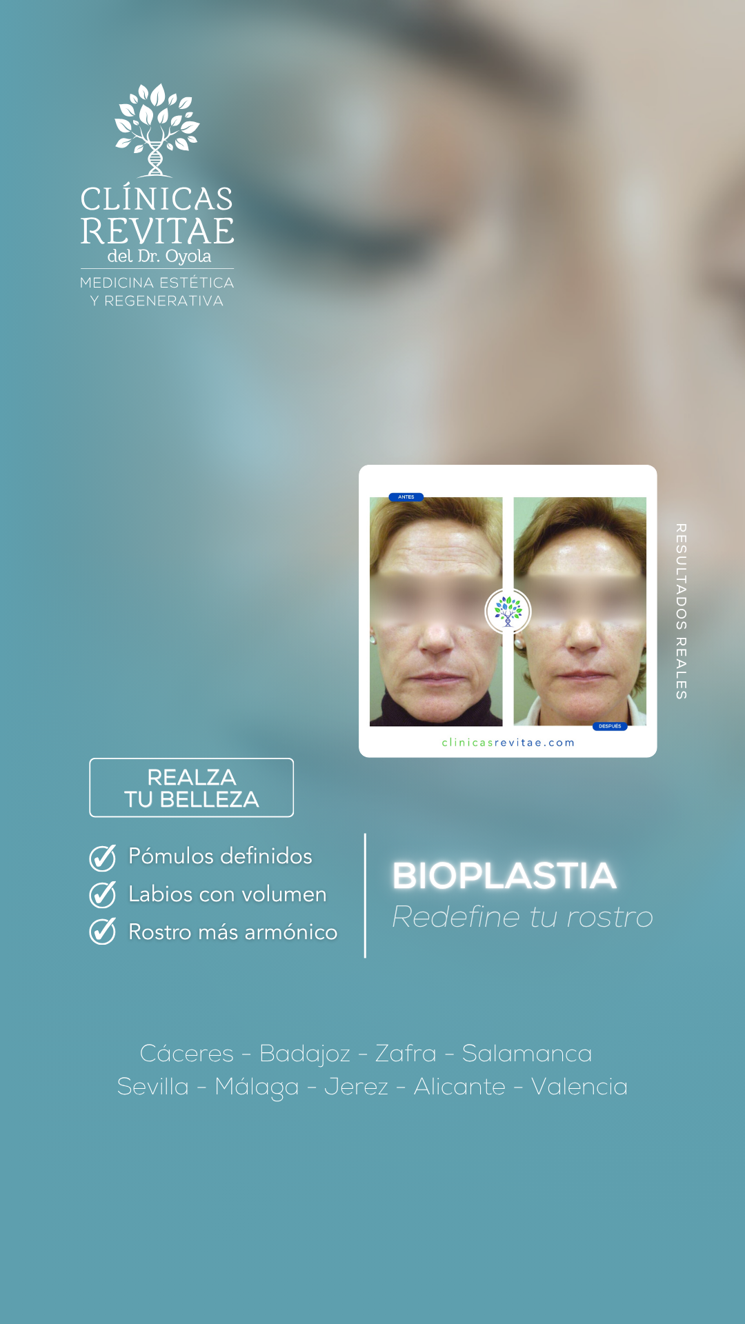 Clínicas Revitae Facebook ad