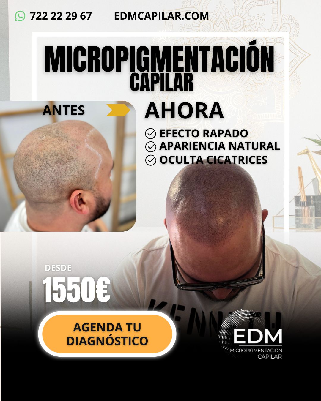 Edm Pigmentación Capilar Facebook ad