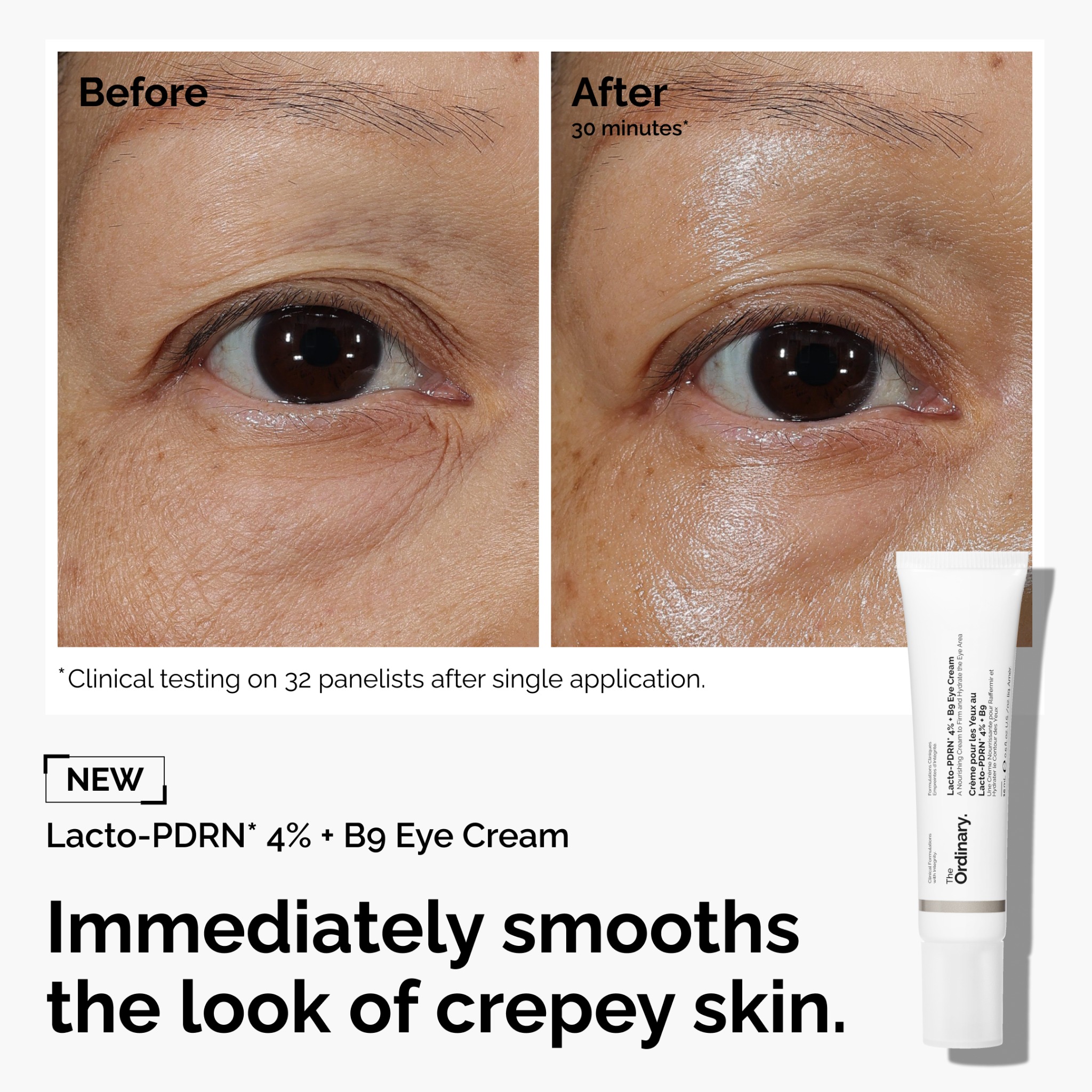 The Ordinary Facebook ad: Made to visibly repair eye skin.