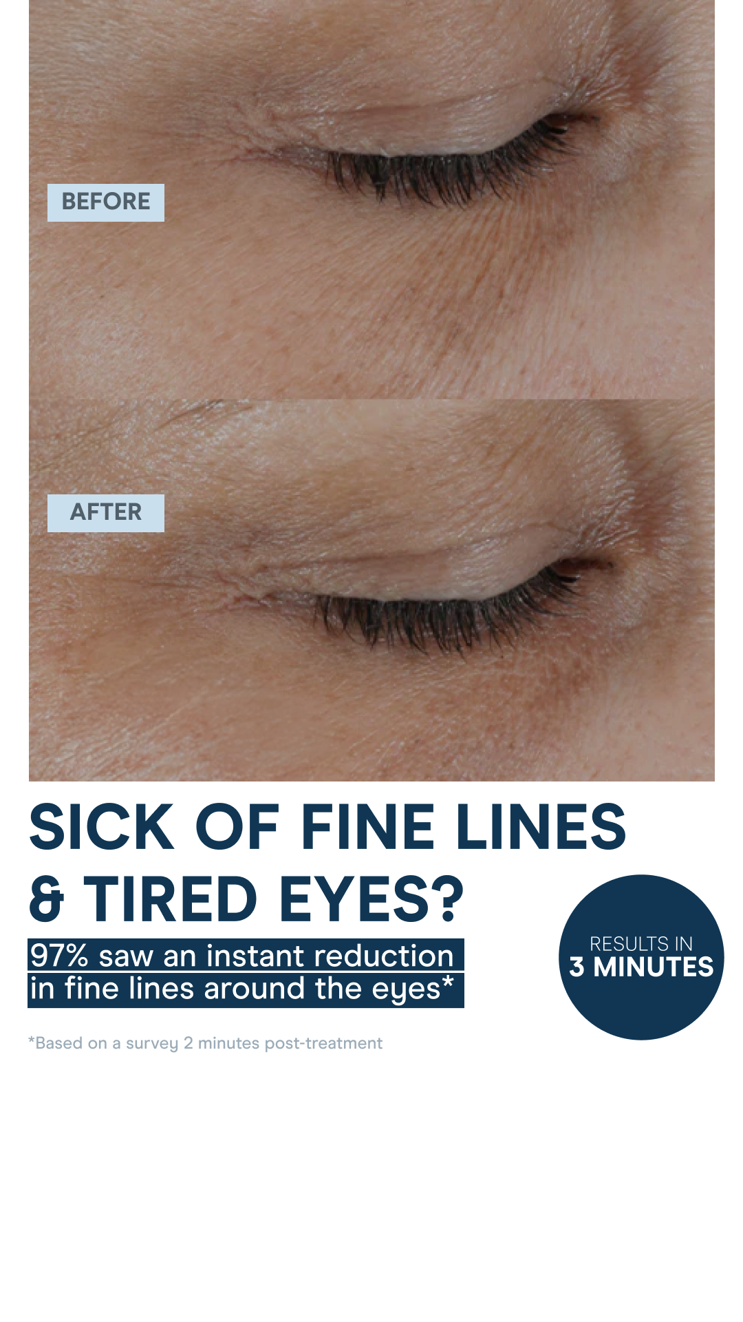 NuFACE Facebook ad