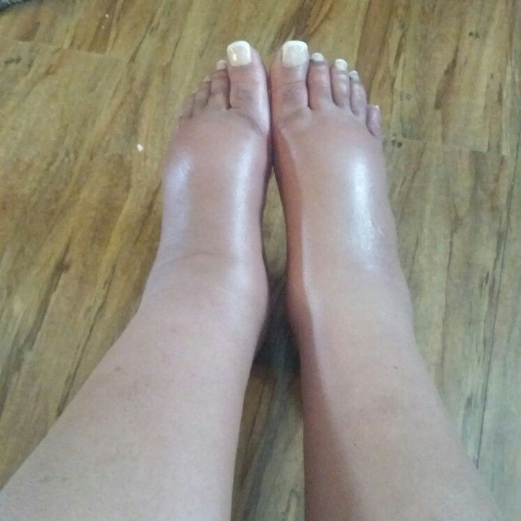 American Foot Association - AFA Facebook ad: New study: 70 million Americans have swollen ankles. but…