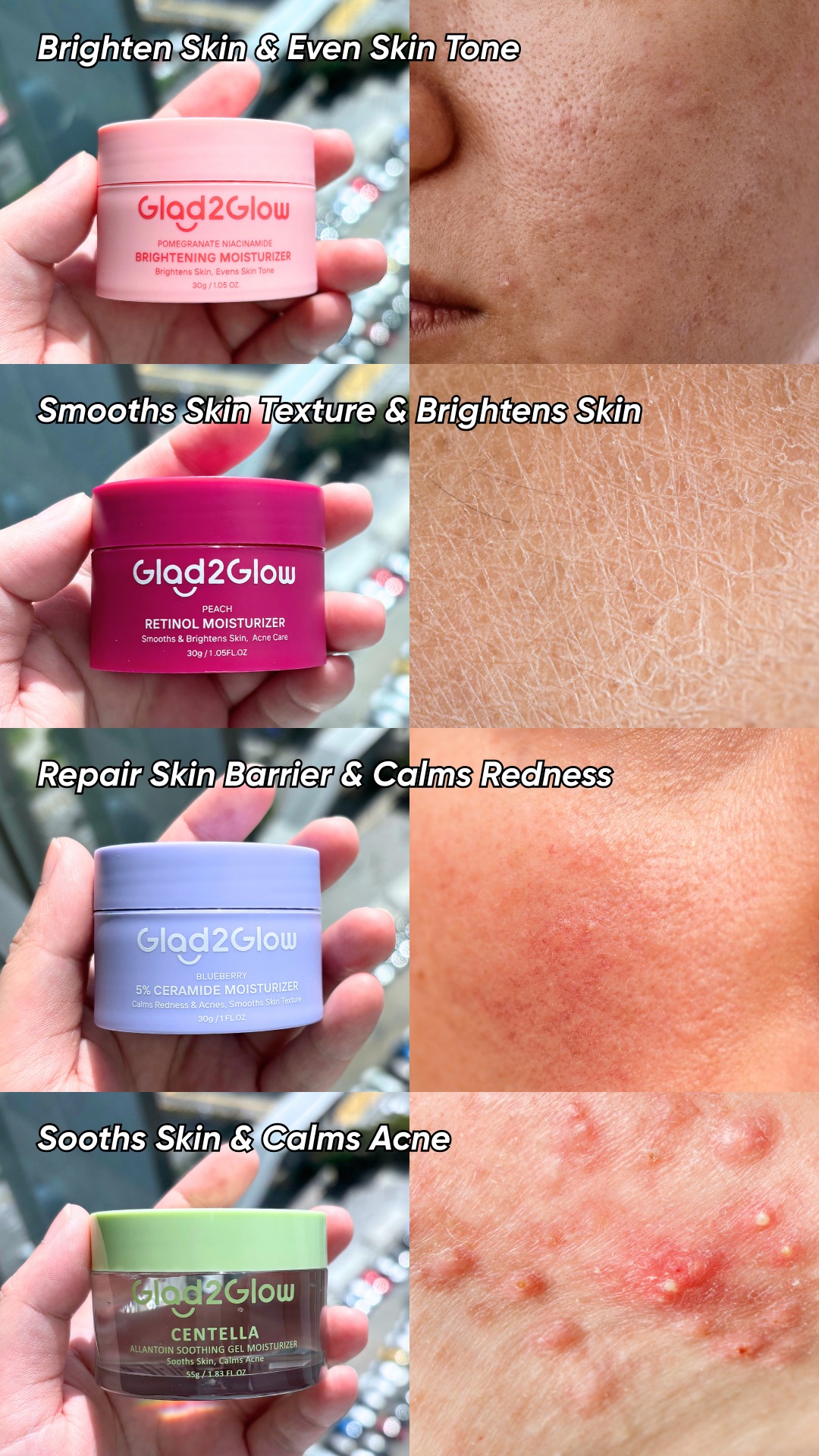 Glad2Glow-Malaysia Facebook ad